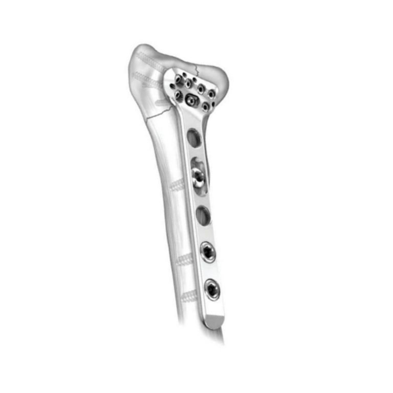 Peri Distal Radius Locking Plate Ø2.7&3.5MM – Volar