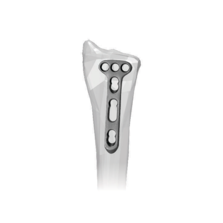 T - Distal Radius Locking Plate Ø2.7MM - Dorsal