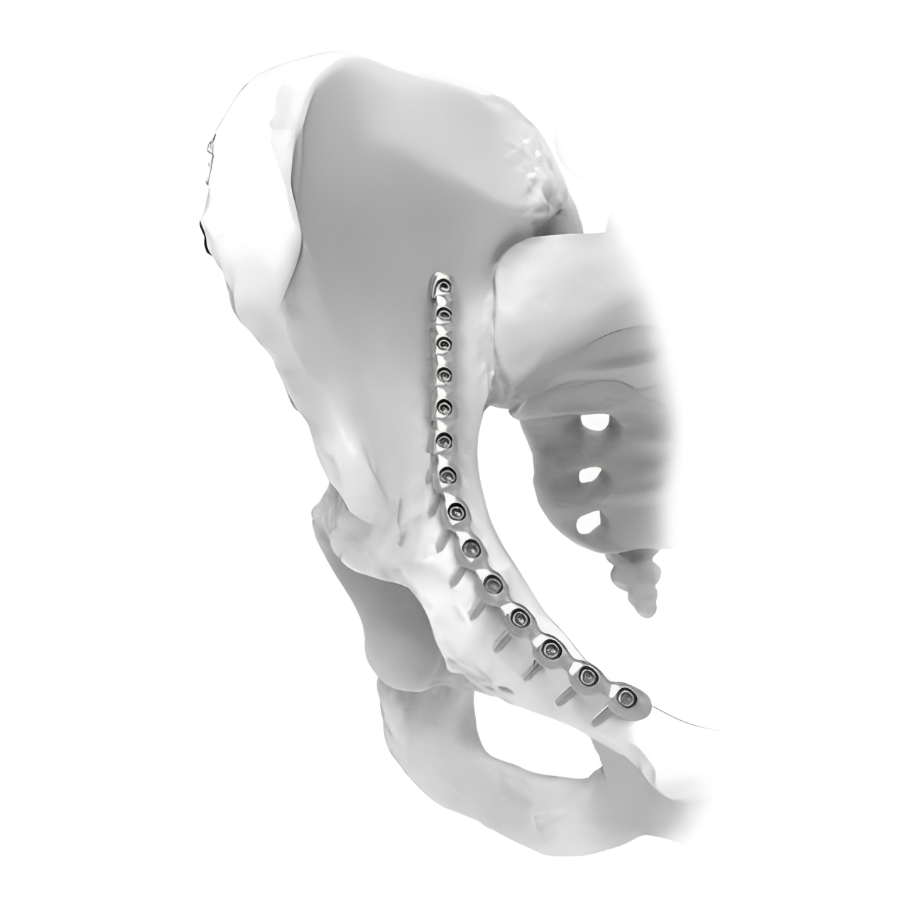 Ø3.5MM J Pelvic LCP