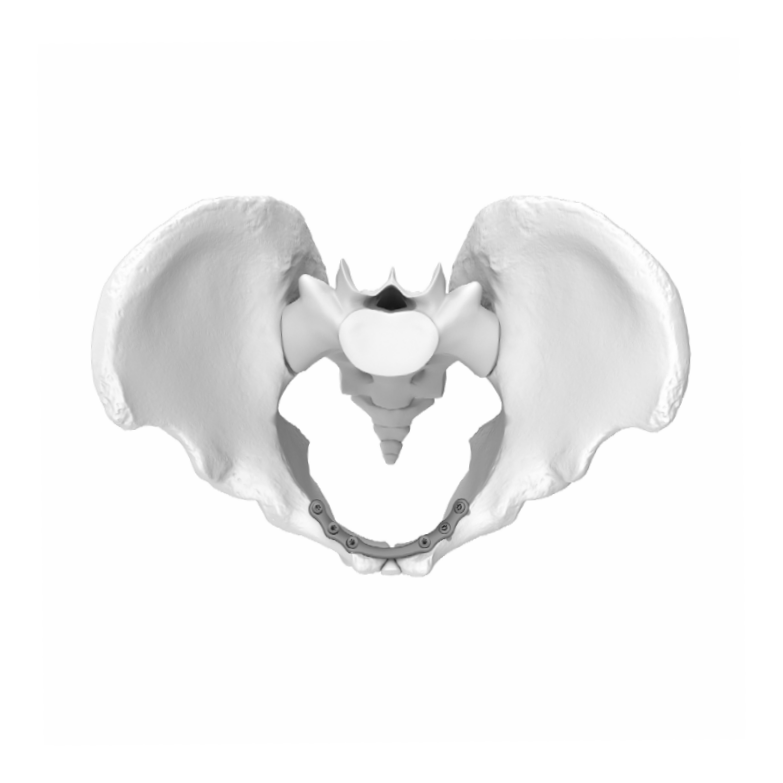 Ø3.5MM Symphyseal Pelvic Plate