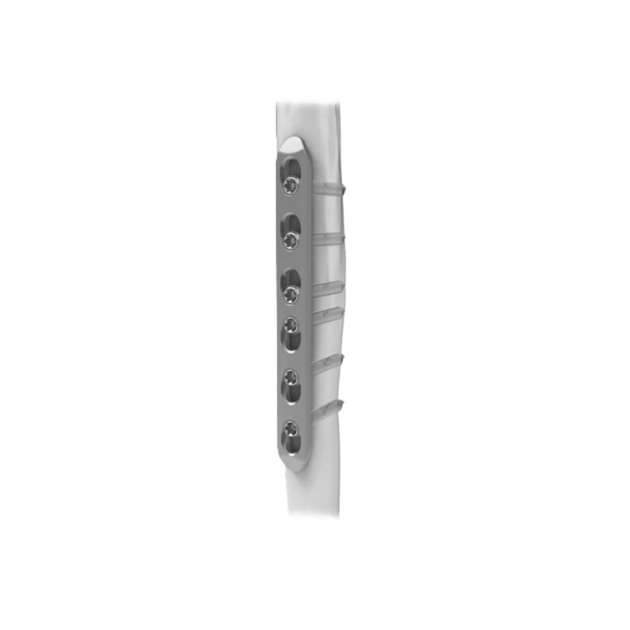 Ø5.0MM Narrow LCP