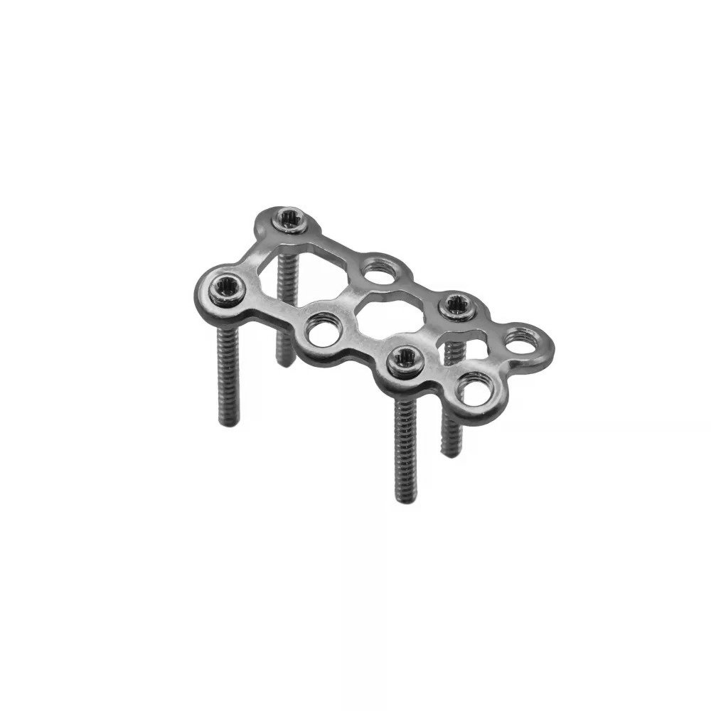 1.5mm Mini Strut Locking Plate (Oblique-angled)2