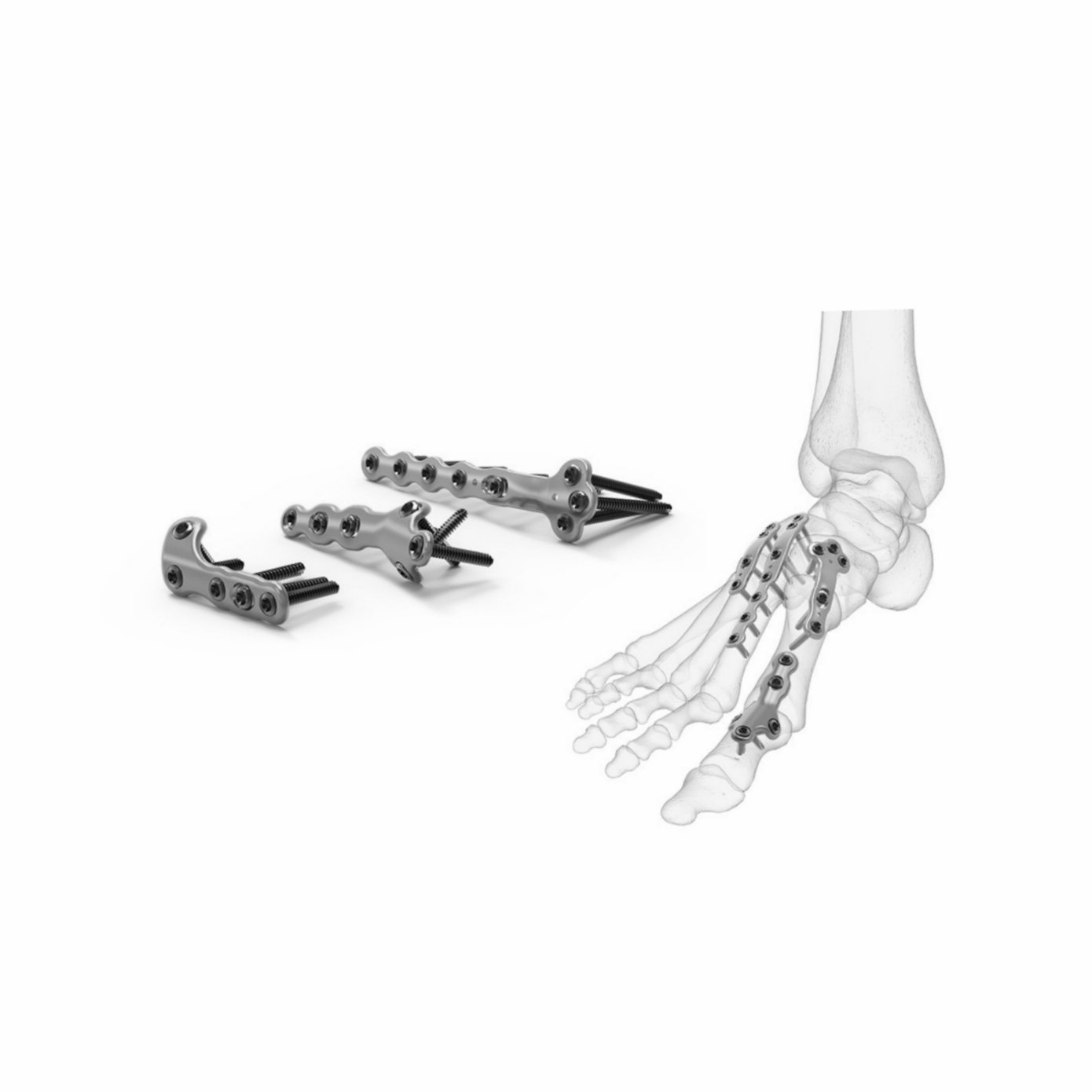 5 SECOND TMT FUSION PLATE 4