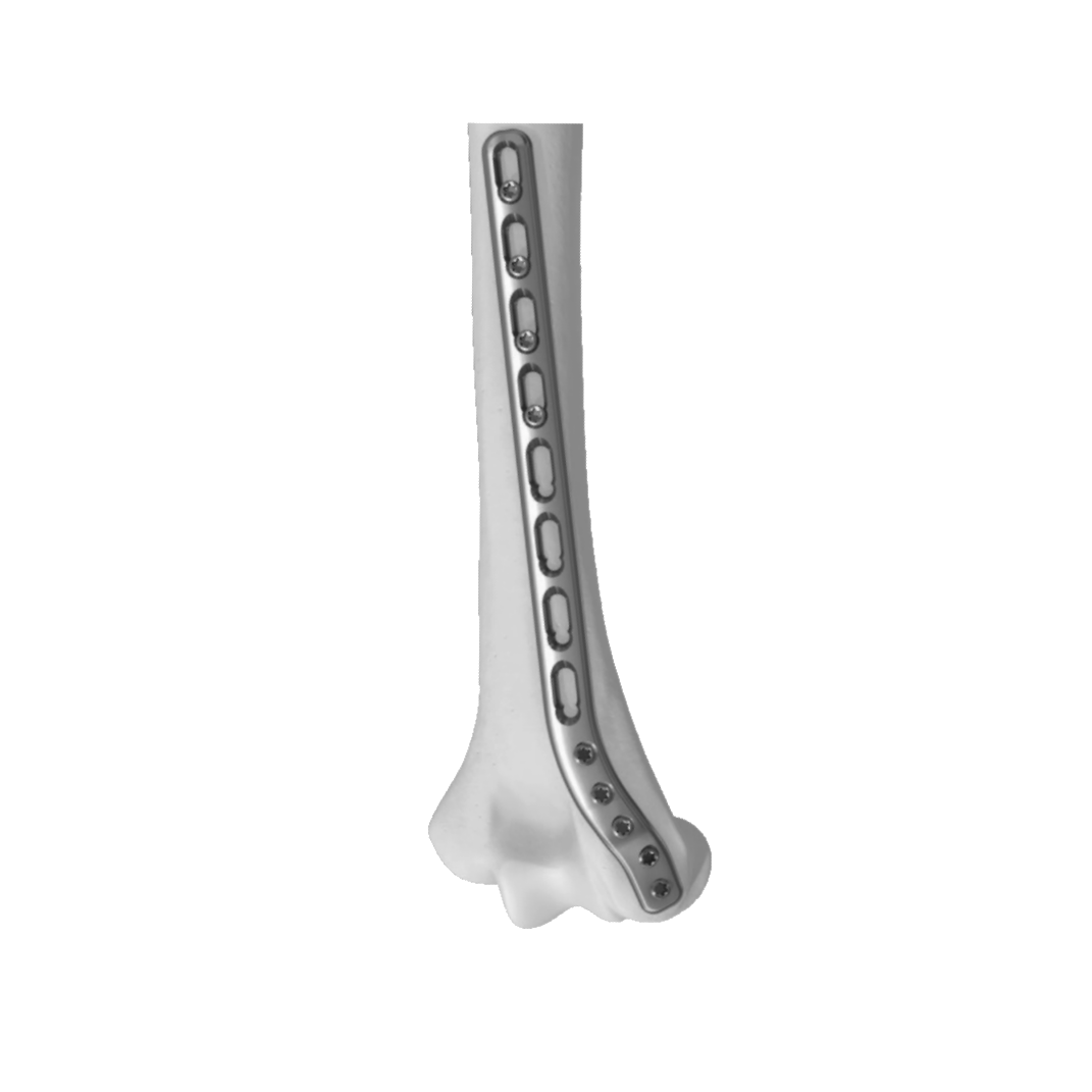 Ø3.5MM Extra - Articular Distal Humerus LCP