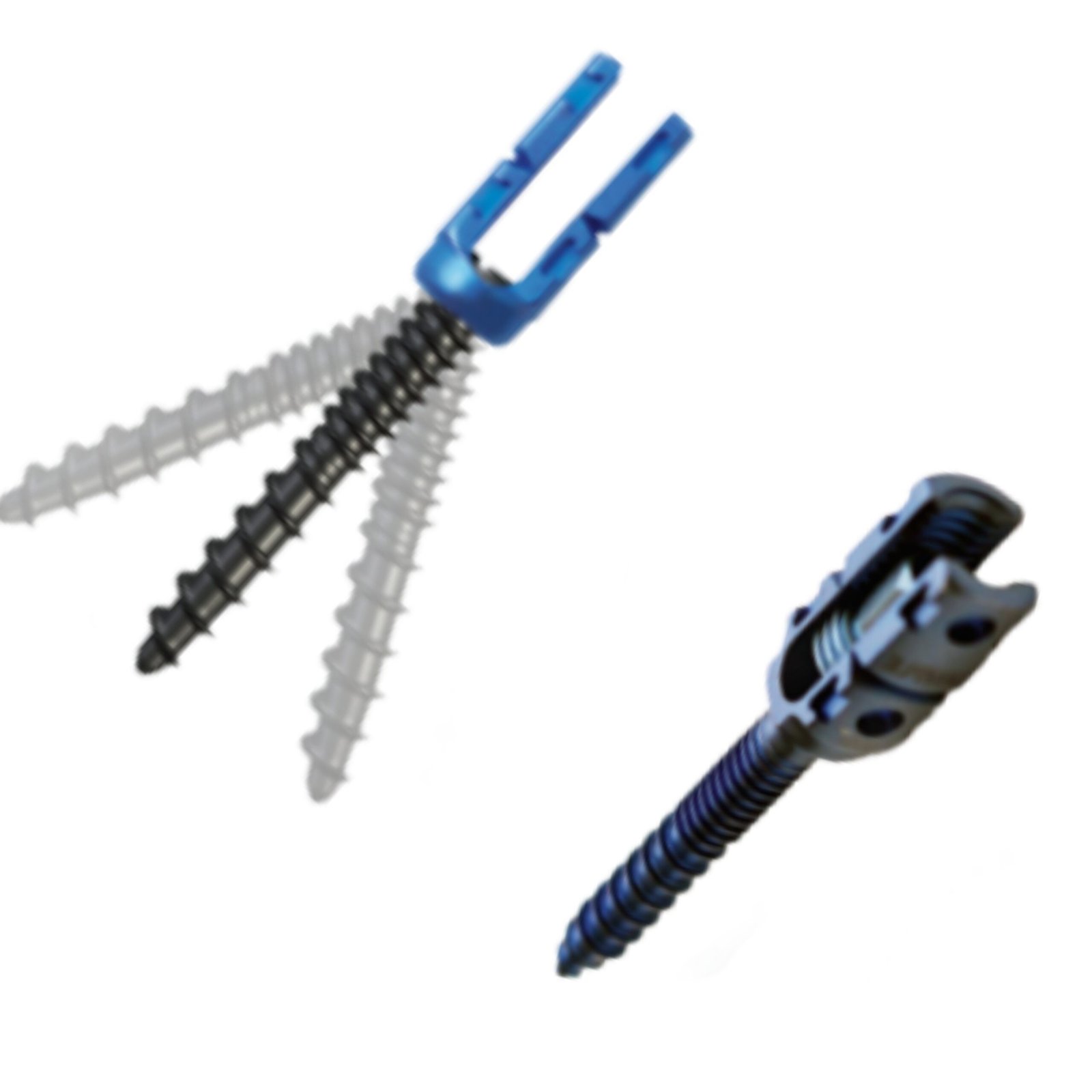 4.Polyaxial Reduction Screw .png A