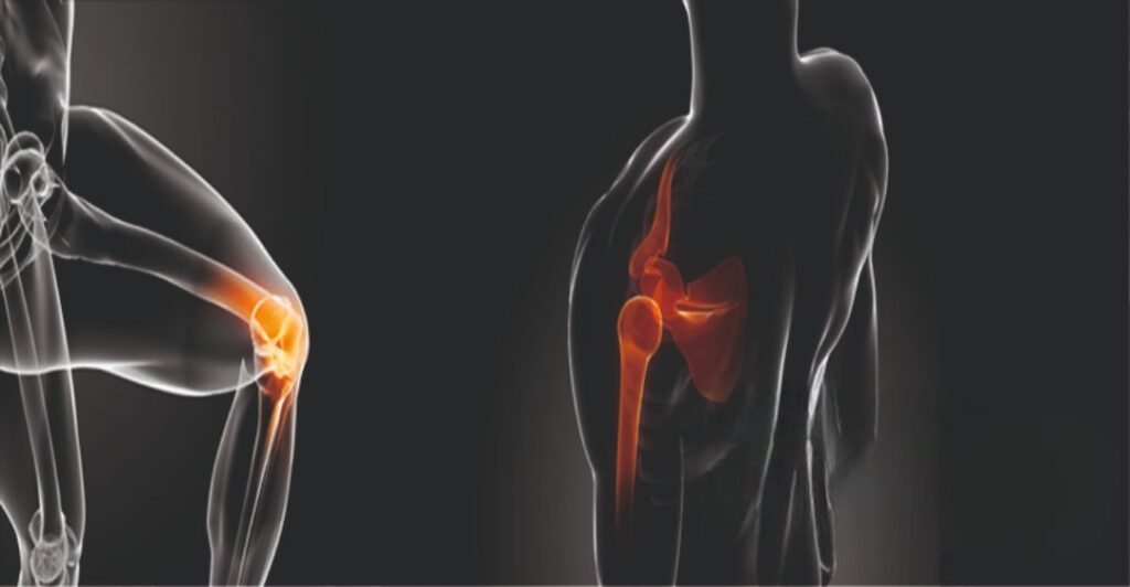 Revolutionizing Healthcare: Exploring Trends In The Orthopedic Implants Industry