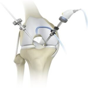 sports medicine